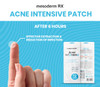 Mesoderm Intensive Acne Patch - Mesoderm | Targets Blemishes for Clearer Skin
