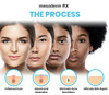 Mesoderm Intensive Acne Patch - Mesoderm | Targets Blemishes for Clearer Skin