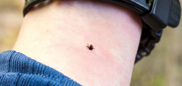 How To Check For Ticks