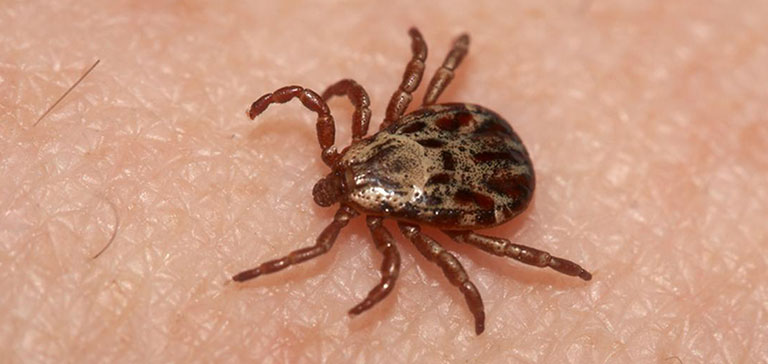 Tick Borne Diseases