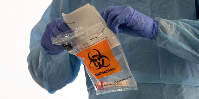 Post Exposure Testing And Management