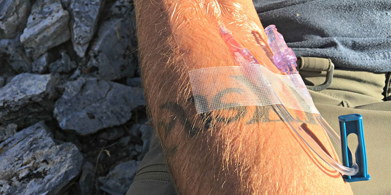 Iv Saline Lock