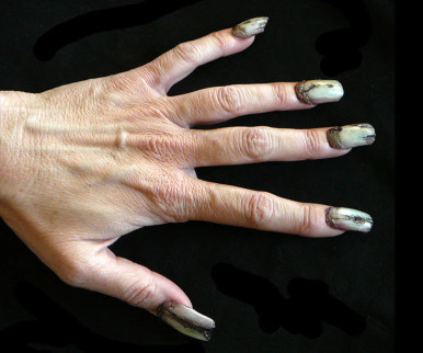 Dental Distortions Creepy Claws Undead
