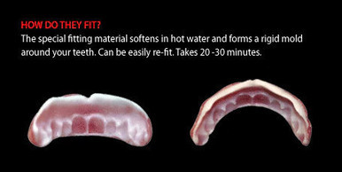 Dental Distortions Gaul FX Fangs 2.0