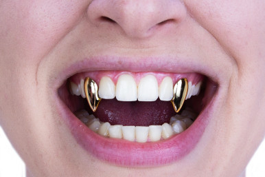 Scarecrow Small Glam Vampire Fangs in Gold (on model). Sold by Norcostco.
