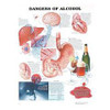 Anatomical Chart, Dangers of Alcohol