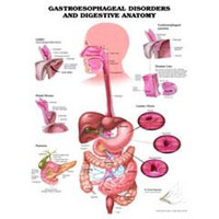 Gastroesophageal Disorders and Digestive Anatomy