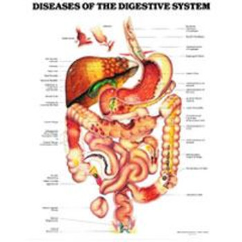 Diseases of the Digestive System