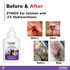 Zymox Ear Solution 0.5% Hydrocortisone, 1.25 oz - Before and After Graphic