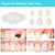 Brige Tooth Repair kit for Filling The Missing Broken Tooth and Gaps-Moldable Fake Teeth and Thermal Beads Replacement Kit for Women and Men