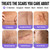 AWD Medical Silicone Scar Tape for Surgical Scars, 1.6in x 60in Roll