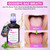 ioRinse RTU Alcohol Free Mouthwash, Soft Mint Flavor, Daily Use, 16.9 fl oz