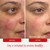 First Aid Beauty Ultra Repair Cream, Intense Hydration, 12 oz