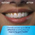 Waterpik Cordless Pulse 3100 Portable Water Flosser, Rechargeable, White