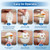 20 pcs Foley Catheter Stabilization Devices,Sterile Individually Packaged,Self-High Adhesive Catheter Supplies for Single/DoubleTube Holder,Catheter Holder