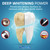 Plus White Teeth Whitening Kit, Tooth Whitening Gel & Mouth Tray (2 oz)