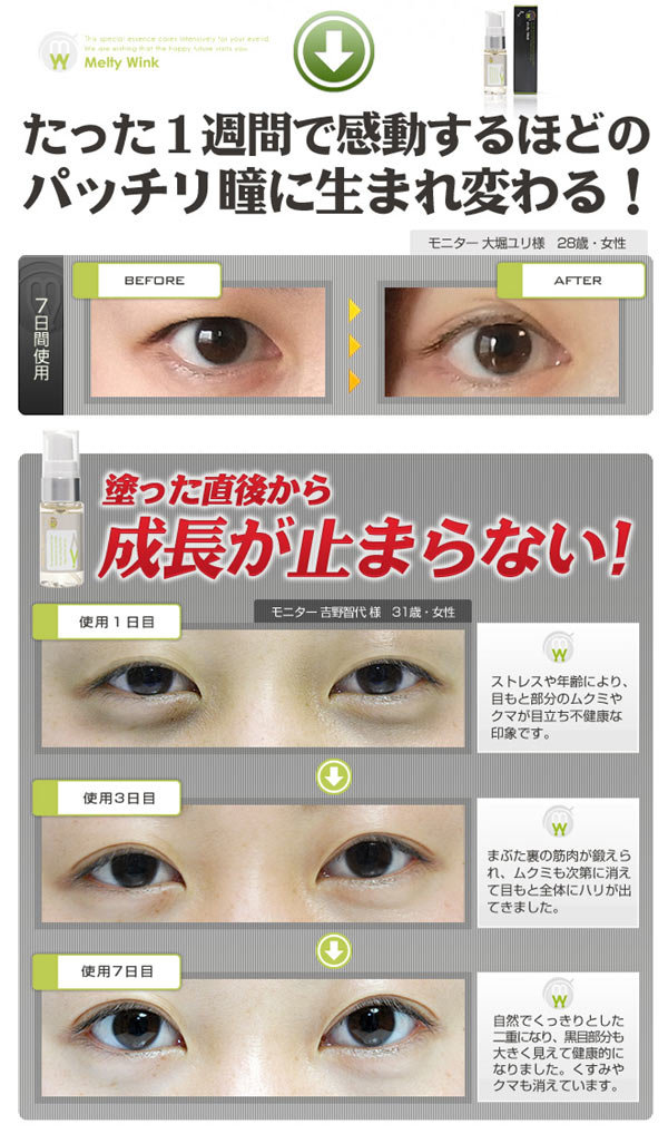 melty-wink-double-eyelid-essence-17ml-2-17-c6.jpg