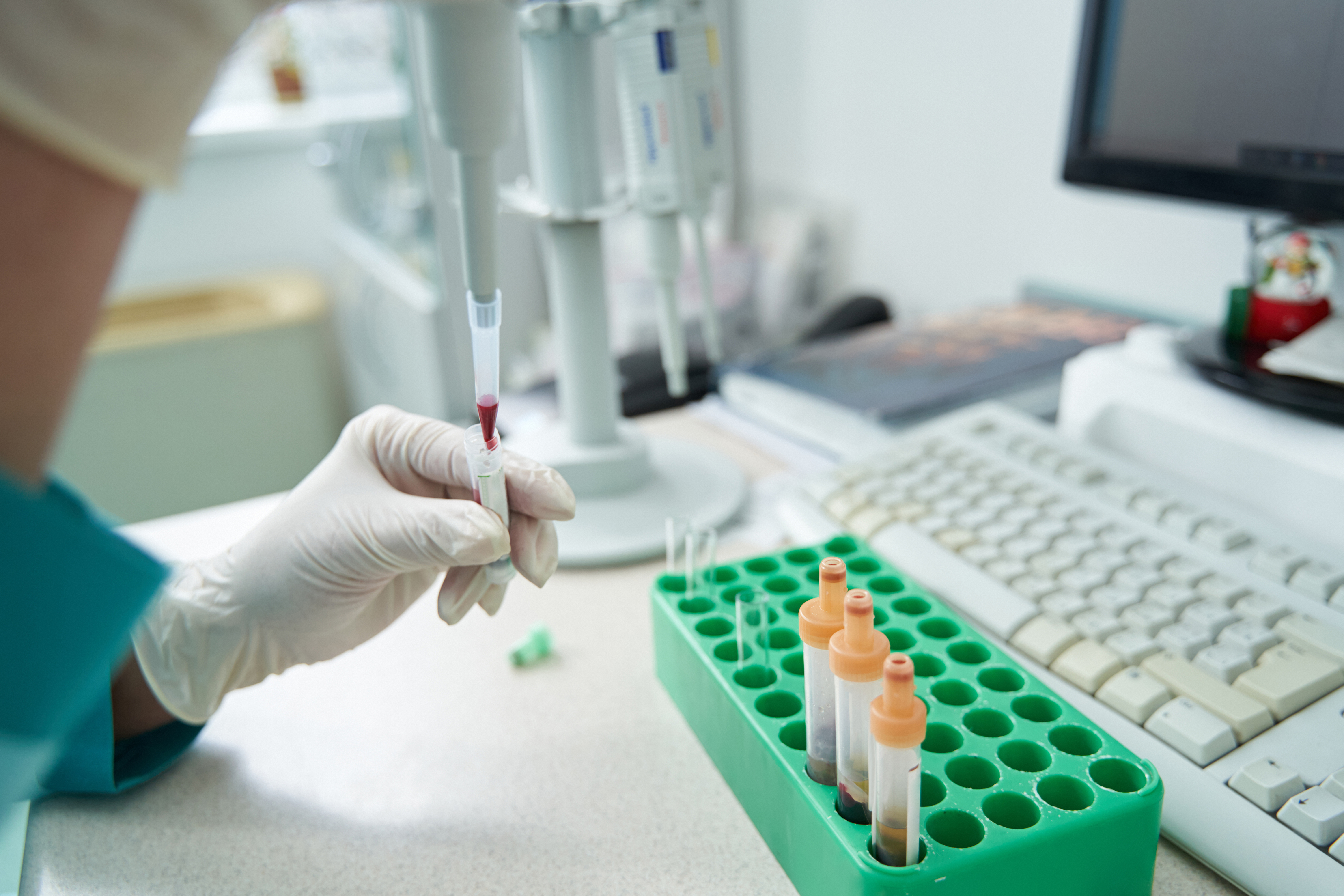 woman-examining-chemistry-blood-tests-before-compu-2023-02-02-00-45-53-utc.jpg