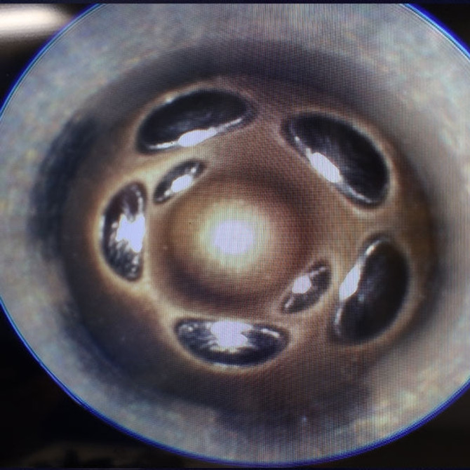 DDP - Dynomite Diesel Products Dynomite Diesel - STAGE-1 (50 HP) Diesel Fuel Injector Set - 1989-1993 Dodge 5.9L 12-Valve - DDP8993-1 