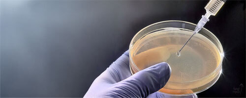 Test your Spores on Agar first