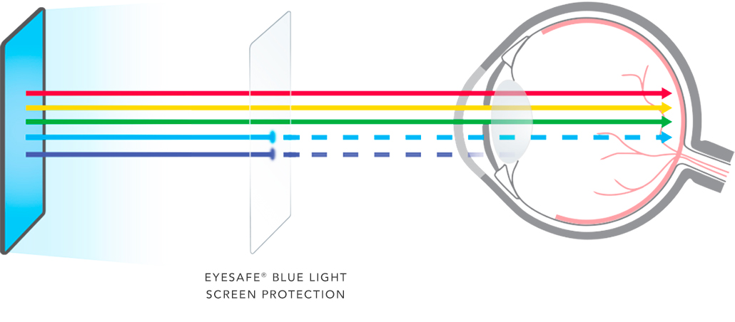 Infographic on Eyesafe Screen Protectors that Reduce High Energy Blue Light 