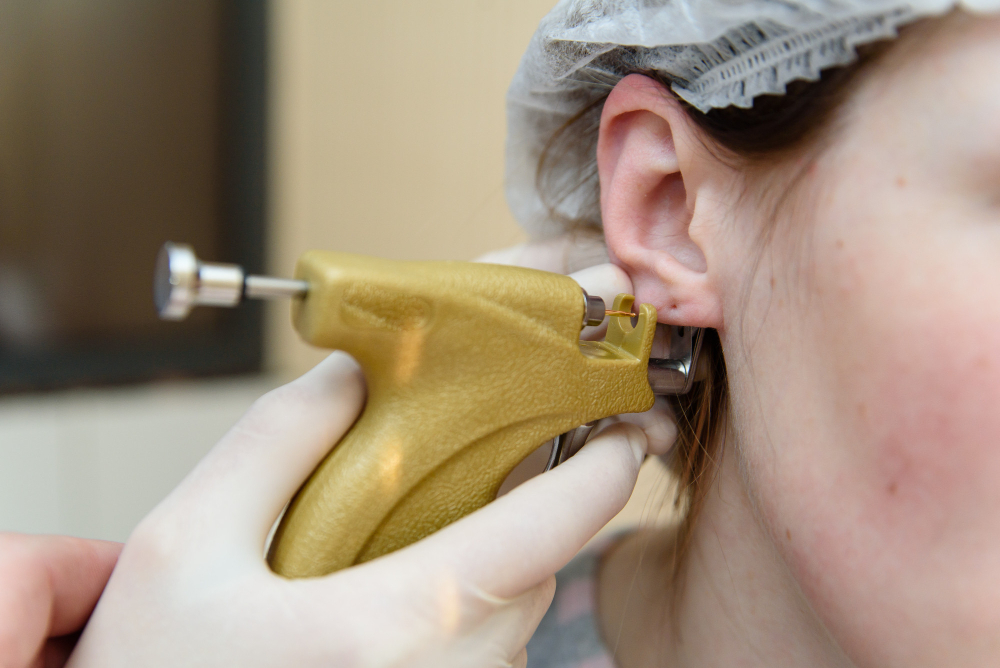 Perforación de lóbulos auriculares