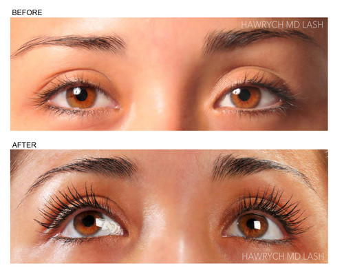 MD Eyelash Enhancer Serum for Longer Thicker Eyelashes | Hawrych MD