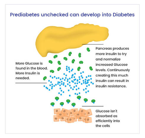 How PreDia® is Different