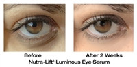 Luminous Eye Serum before & After