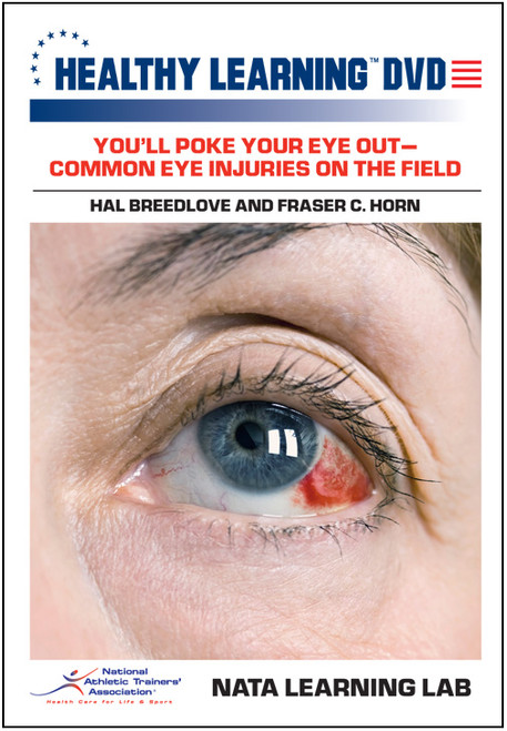 You'll Poke Your Eye Out-Common Eye Injuries on the Field