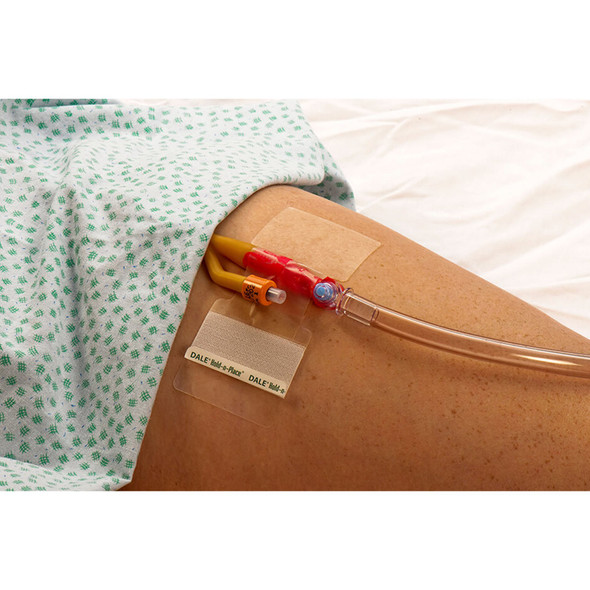 Dale Hold-n-Place Catheter Holder