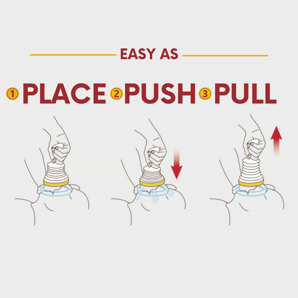 1252455_KT Airway Clearance Device LifeVac Adult / Pediatric 1/KT 1252455_KT Airway Clearance Device LifeVac Adult / Pediatric 1/KT