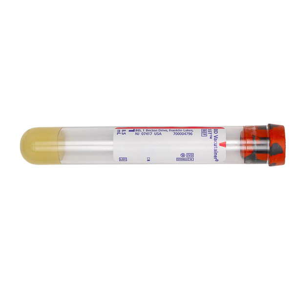 BD Vacutainer SST Venous Blood Collection Tube Serum Tube Clot Activator / Separator Gel Additive 16 X 100 mm 8.5 mL Red / Gray Mottled Conventional Closure Plastic Tube