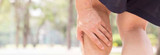 What Causes Muscle Cramps?
