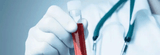 What Are Inflammatory Markers, And Why You Should Check Them
