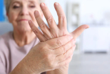 Free Seminar - Fibromyalgia Replay