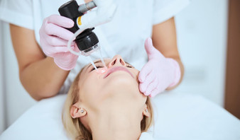 CO2 Laser - Undereye
