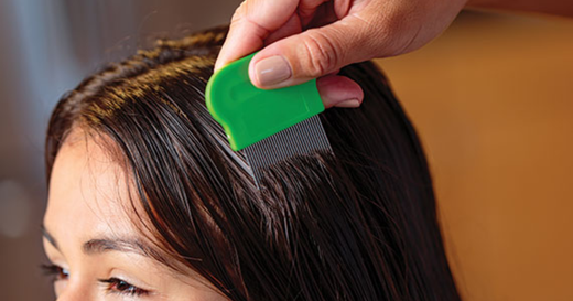 The Best Lice Treatment For Kids At Home - Safe, Gentle, and Effective