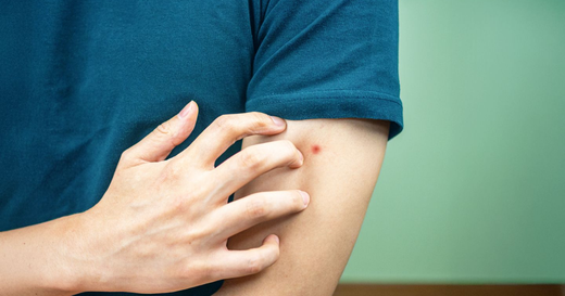How To Clean Skin Affected By Mites Safely - Your Step-By-Step Guide