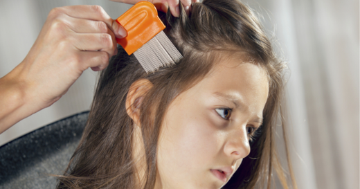 How To Get Rid Of Head Lice Naturally In One Treatment - Does It Work?