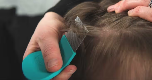 How to Remove Lice Fast - The Parents’ Complete Action Plan