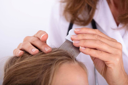 Are Some People More Prone to Lice Than Others?