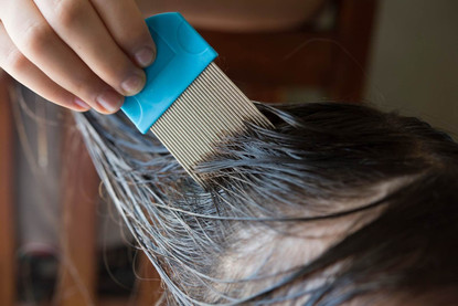 Living With Lice? Four Ways to Get Rid of Lice for Good