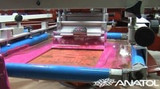 Digital and Screen Printing