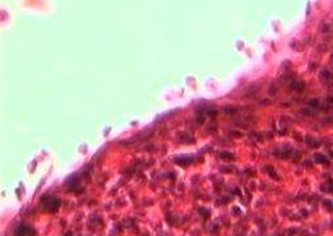 costia.jpg costia.jpg