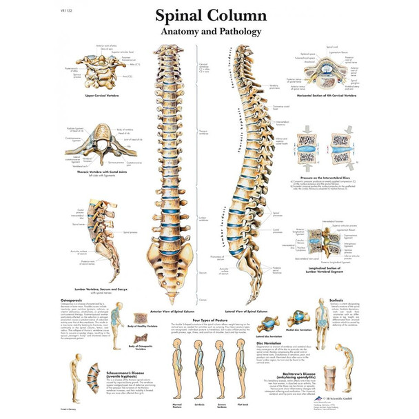 Spinal Column Laminated Chart 20" x 26"