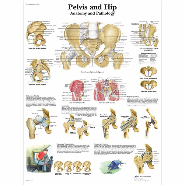 Pelvis and Hip Chart Laminated Chart 20" x 26"