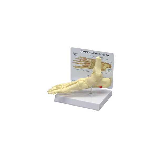 GPI Anatomicals Foot/Ankle Plantar Faciitis