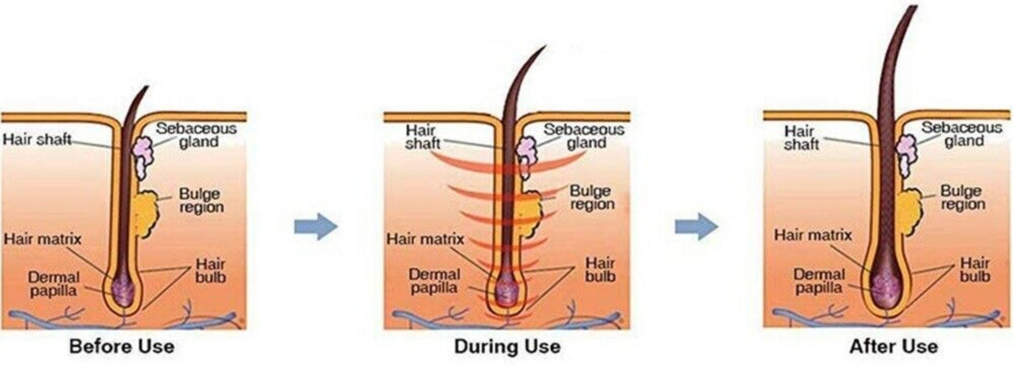 StimuROLLER FACE (0.3 mm) – DS Healthcare Group