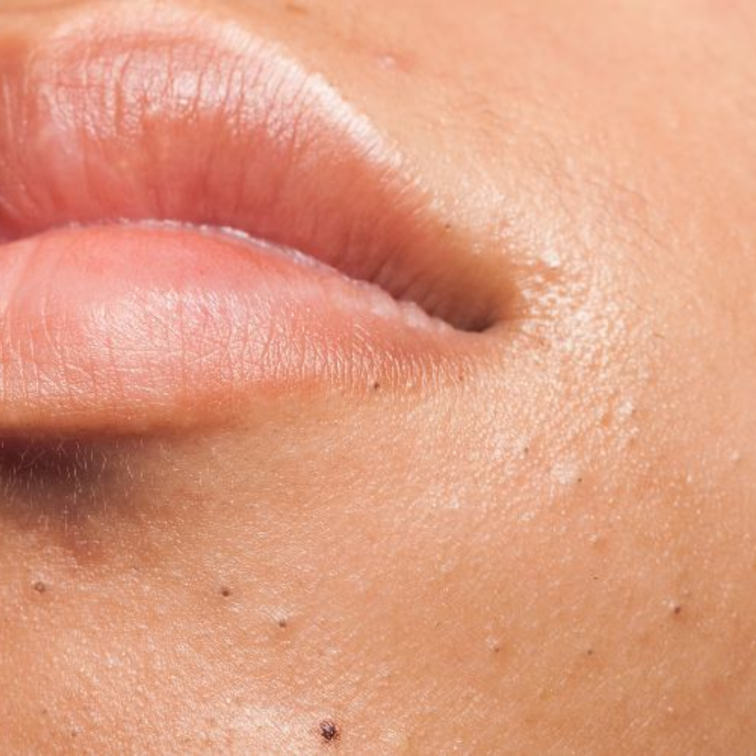 Pollution & Urban Stress